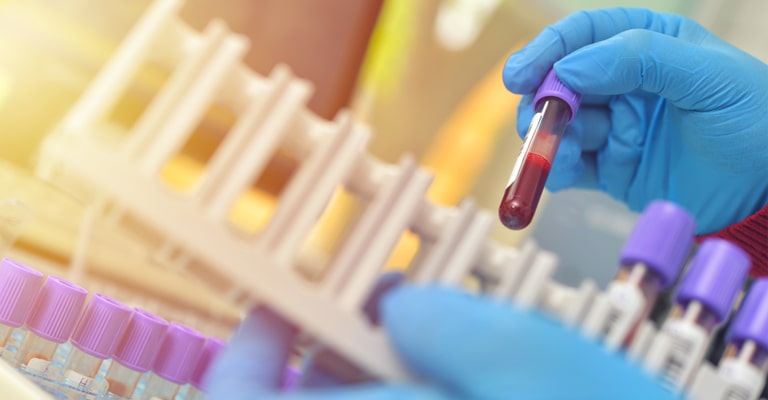 Promisecare Medical Group - A person is holding a blood test tube in a hematology laboratory.