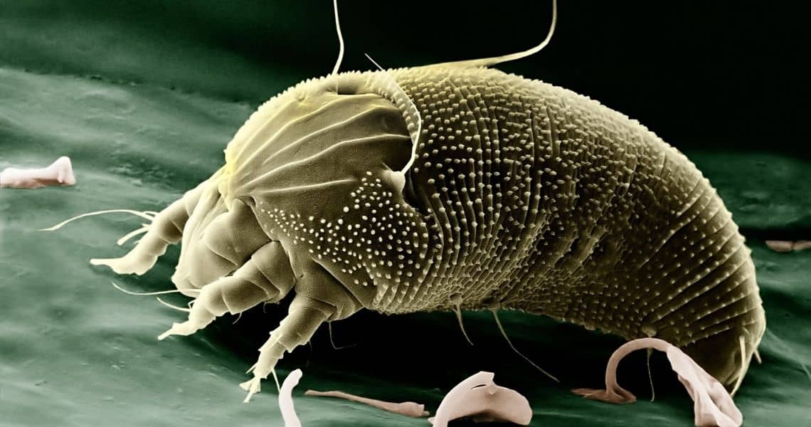 Promisecare Medical Group - Close-up of a water bear (tardigrade) viewed under a microscope, showcasing its segmented body and legs.